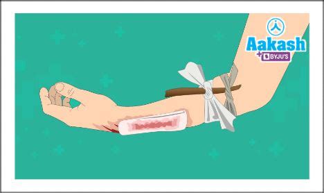 Blood and Lymph Difference: Function, Composition, Similarities | AESL