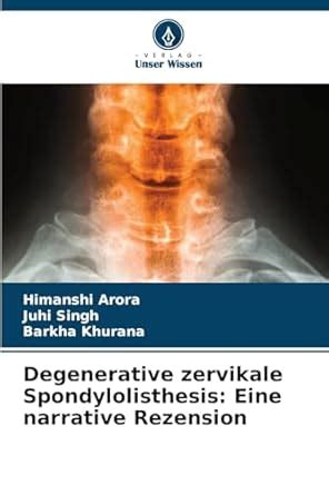 Buy Degenerative zervikale Spondylolisthesis: Eine narrative Rezension ...