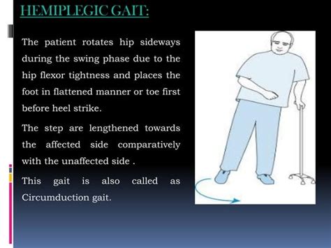Image result for Contralateral Gait