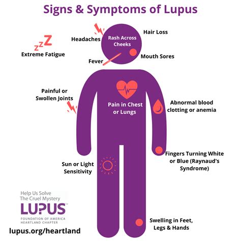 Raise Awareness of Lupus | Heartland | Lupus Foundation of America