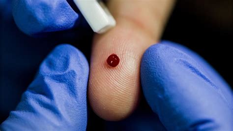 Análisis de sangre seca, el ambicioso plan contra el dopaje para Tokio 2020