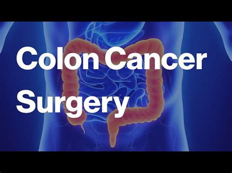 Image result for Colon Cancer Surgery Procedure
