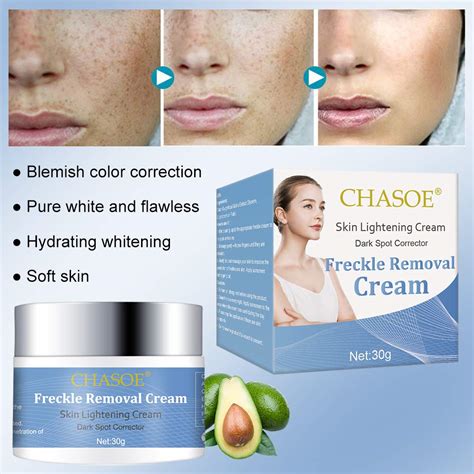 Freckle Removal Cream, Whitening Cream, Lightening Cream, Skin ...