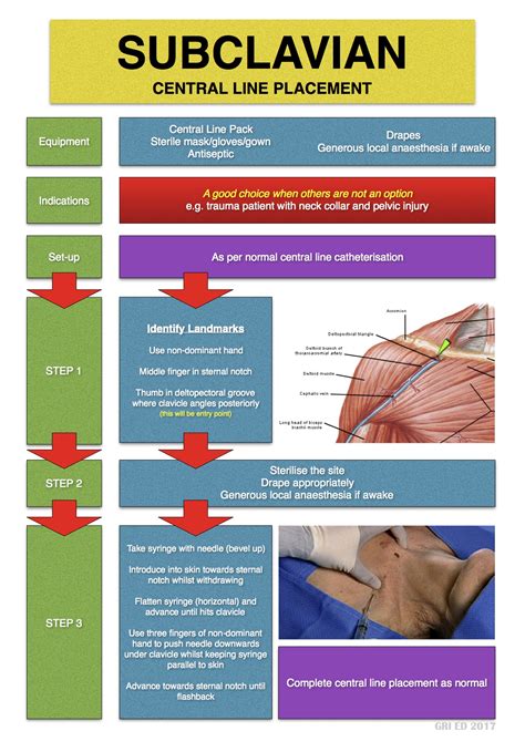 Subclavian Line Anatomy