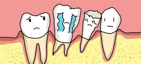牙齿松动是什么原因造成的呢？_咬合_治疗_危害