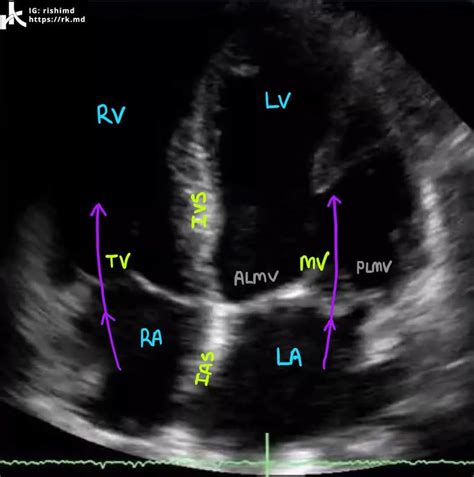Transthoracic Echocardiography Tte