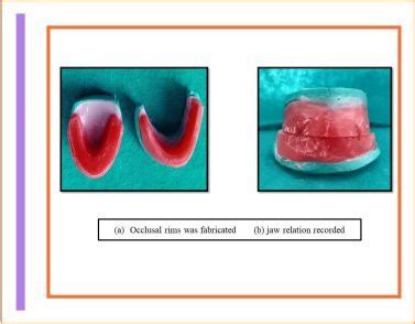 Best Private Dental College in UP, TMDC&RC | BDS & MDS