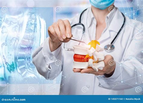A Doctor Operating with Herniated Disc Stock Photo - Image of modern, orthopedic: 145071160