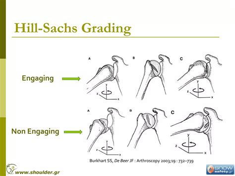 Bone defects thessal2010 | PPT