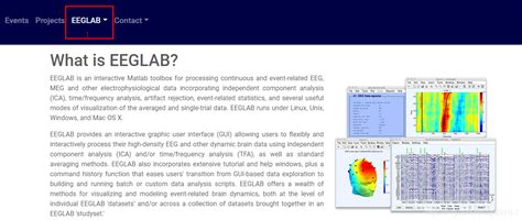 EEG MATLAB Load File 的图像结果