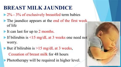 NEONATAL JAUNDICE.pptx By SASIRAVI Msc | PPTX