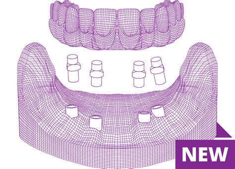 Magnetic implant bar - Magnet-X | Panthera Dental