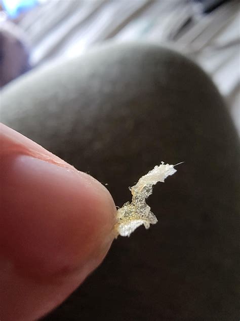 dry skin that grows in my ear canal ever few days, if there is interest ...