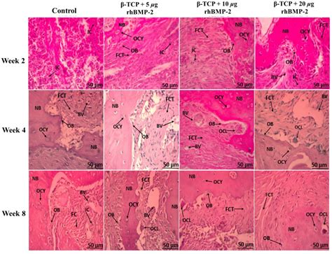 Dose-Dependent Osteoinduction by rhBMP-2-Loaded β-Tricalcium Phosphate ...