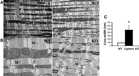 Image result for Z-Line Muscle Cell