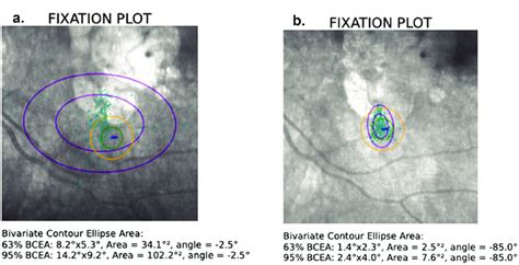 Image result for Role Fixation