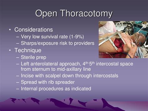 Image result for Thoracotomy Procedure Clamshell