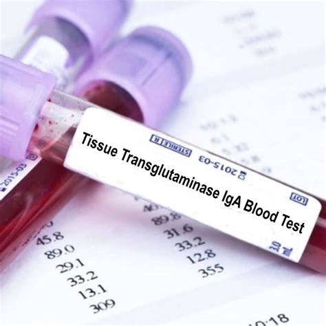 TISSUE TRANSGLUTAMINASE (tTG)-IgA ANTIBODIES test Online in Dhaka ...