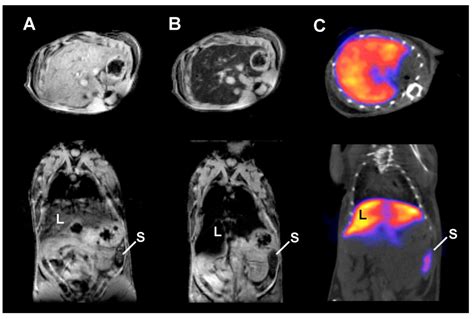 Radiolabeled Iron Oxide Nanoparticles as Dual Modality Contrast Agents in SPECT/MRI and PET/MRI