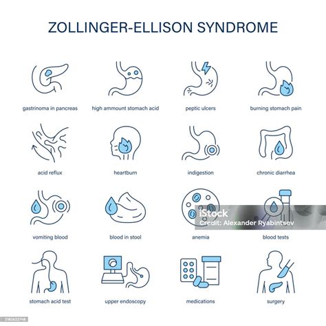 Symptoms Of Zollinger Ellison Syndrome
