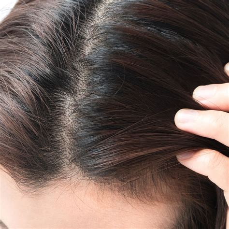 Lifestyle & Ayurvedic Formulas: A Natural Way to Reverse Hair Issues ...
