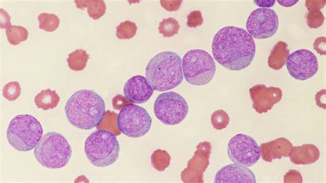 Fachthemen - Medizin - Universimed - Medizin im Fokus