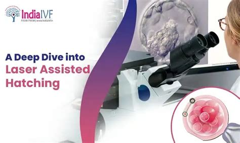 Laser Assisted Hatching in IVF – India IVF Fertility Clinic