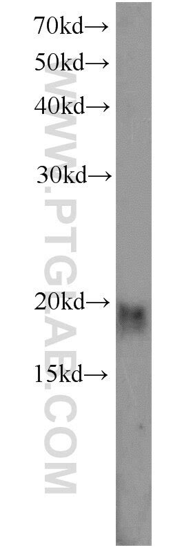 CIRBP antibody (10209-2-AP) | Proteintech