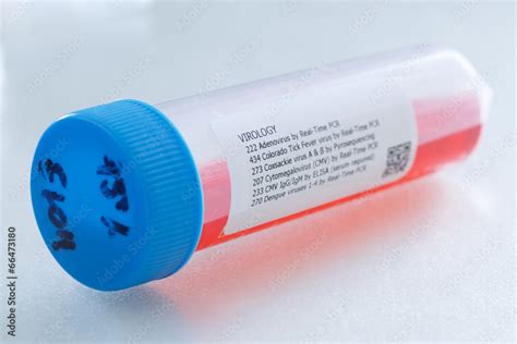 Image result for Molecular Lab Operating PCR