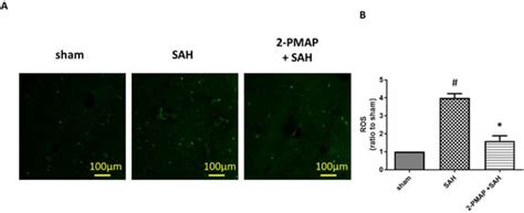 2-PMAP Ameliorates Cerebral Vasospasm and Brain Injury after ...