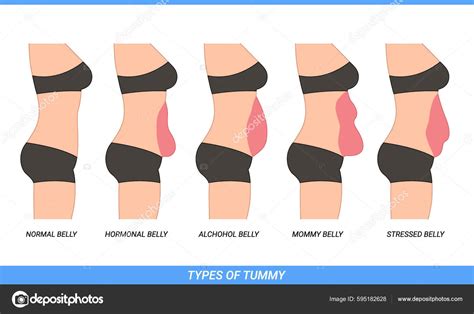 Illustration Types Tummies Woman Stock Vector Image by ©airtafolo@gmail ...