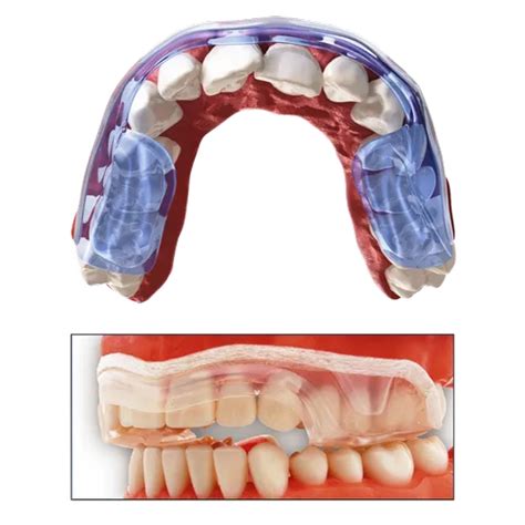 AQUALIZER - AQUALIZER instant hydrostatic splint Wholesale Trader from ...