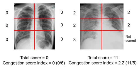 Stages Of A Chest Cold