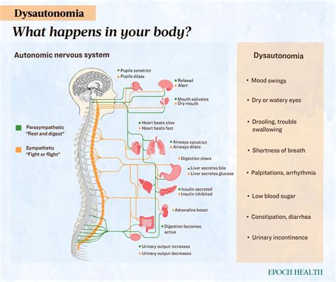 Dysautonomia: Symptoms, Causes, Treatments, And Natural Approaches | ZeroHedge