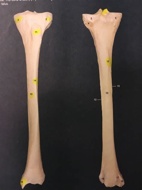 Image result for Ribstride Tibia