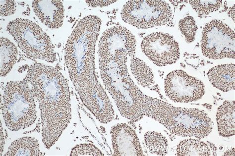 Mono/Di/Tri-Methyl-Histone H3 (Lys4) antibody (84908-1-PBS) | Proteintech