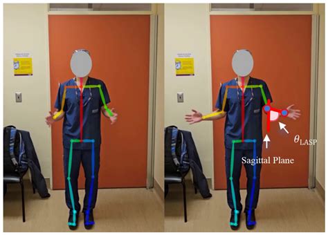 Automated Assessment of Upper Extremity Function with the Modified ...