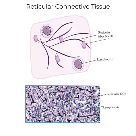 Reticular Tissue Reticular Connective Tissue Lymph Node 250x At 35mm