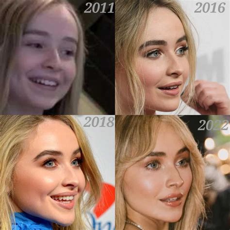 🦷 Les nouvelles dents de Sabrina Carpenter Avant et après