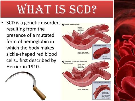 Image result for Applying SCD