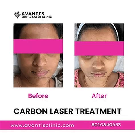 What Causes Dark Spots on Your Face? Common Causes Explained