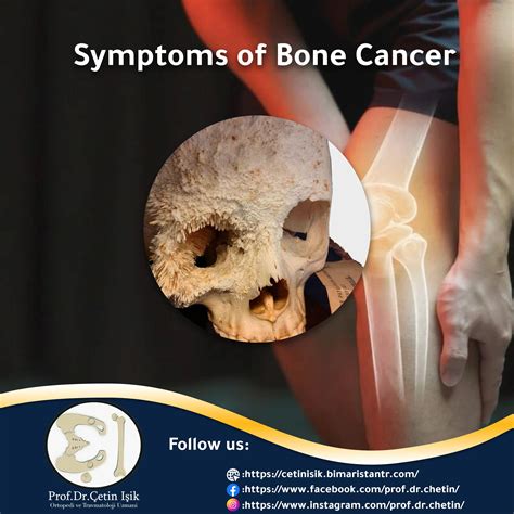Bone Cancer Symptoms