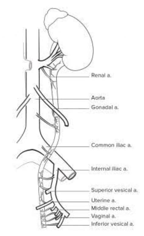 Urtereic masss involving iliac vessels - Brainly.in