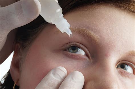 Tratamiento de la conjuntivitis | Optometristas.org