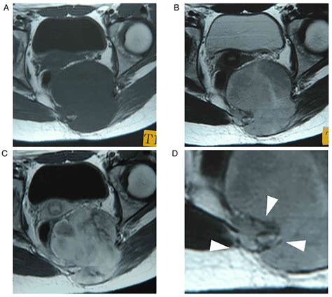 Molecular and Clinical Oncology