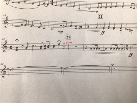 What does this symbol mean? A breath mark perhaps? I couldn’t find ...