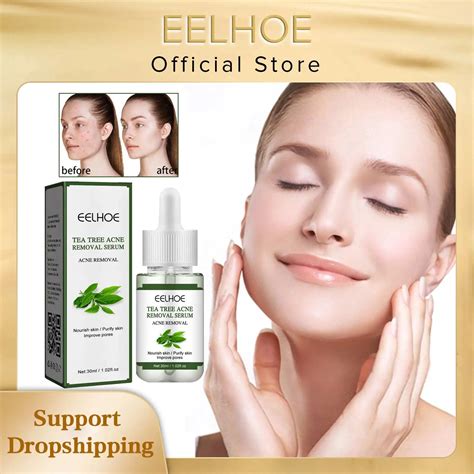 Tea Tree Oil Acne Before And After