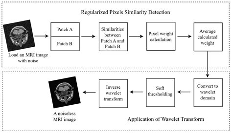 Denoising of Nifti (MRI) Images with a Regularized Neighborhood Pixel ...