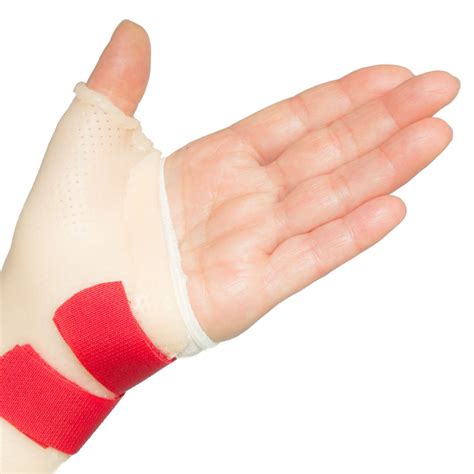 de Quervain’s Tenosynovitis - Berry Physiotherapy | Mobile Physiotherapy Toronto