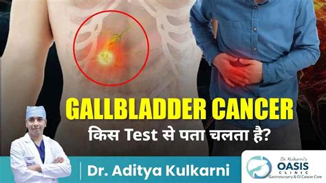 Image result for Gallbladder Test